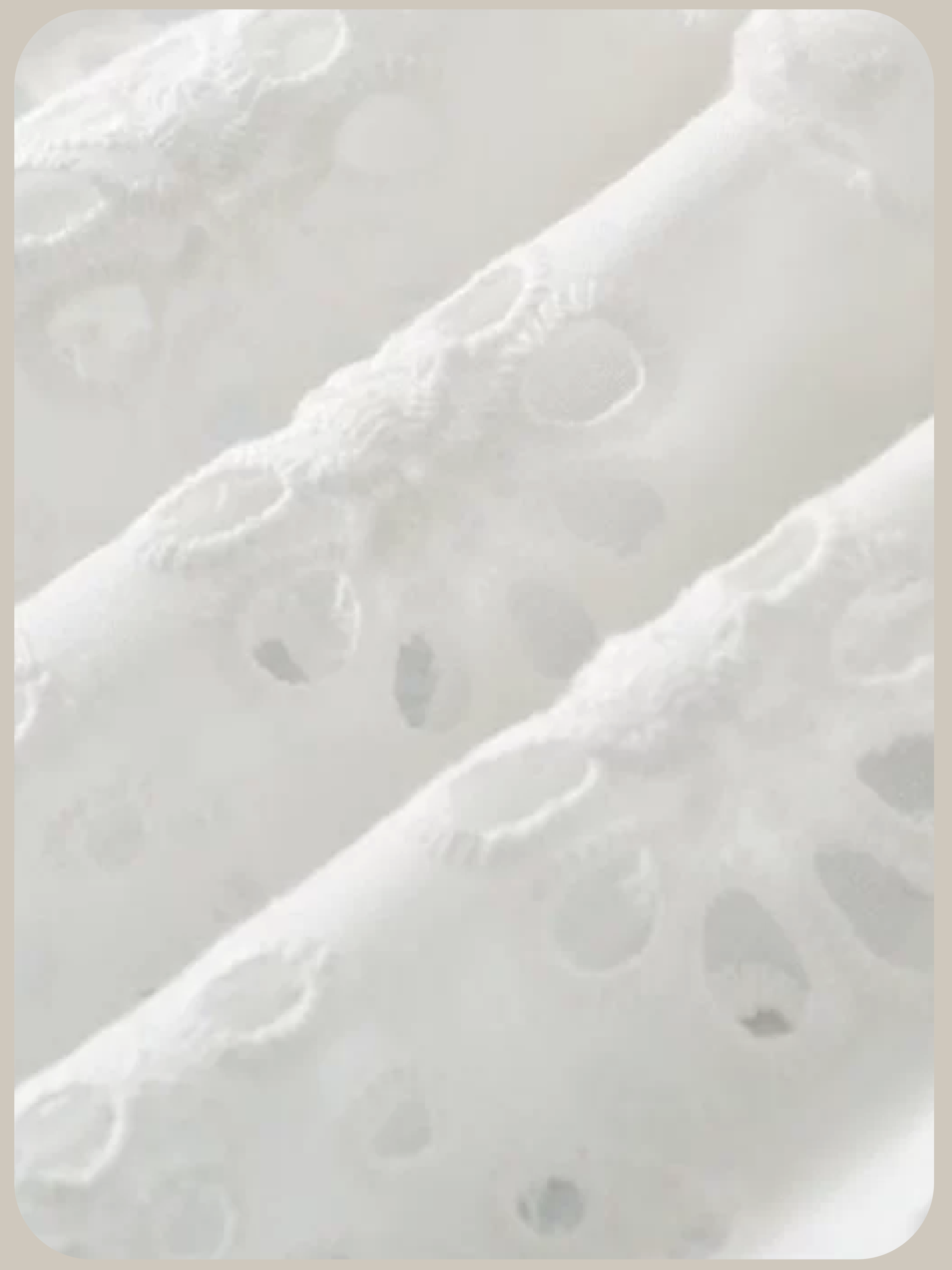 Ballet Lace Overlay Skirt/バレエコアレーススカート